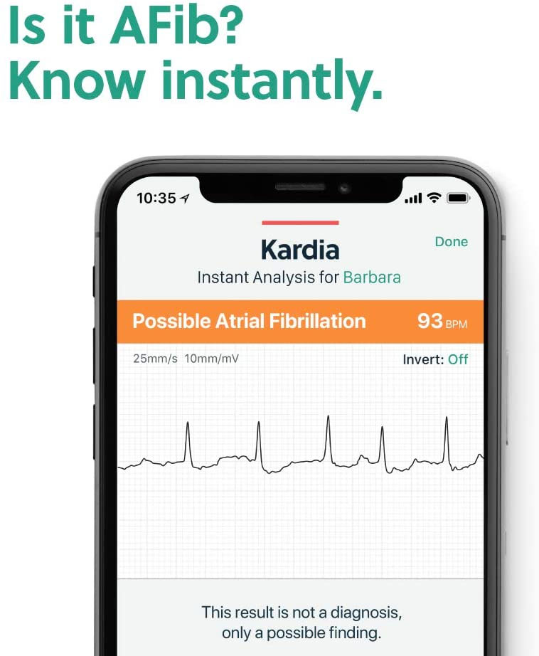 KardiaMobile EKG Tech for Heart Health